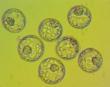 Frisco Institute for Reproductive Medicine (FIRM) Embryonic Imaging...